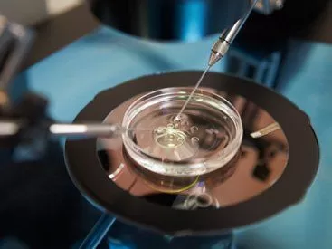 IVF treatment