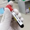 Know your enhanced Fertility