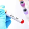 Know your Ovarian Reserve