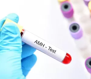 Know your Ovarian Reserve