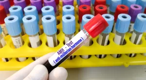 Anti-Mullerian Hormone (AMH) and Its Role in Fertility
