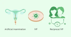 Reciprocal IVF process for same-sex female couples planning shared motherhood.